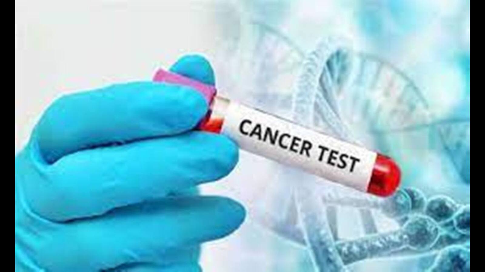 Cancer Screening